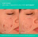 Breakout Biotic Moisturizer Test.webp